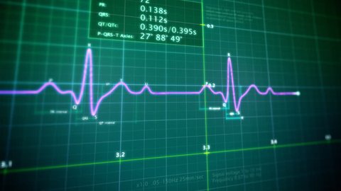 ecg monitor screen hd 1080p high Stock Footage Video (100% Royalty-free ...