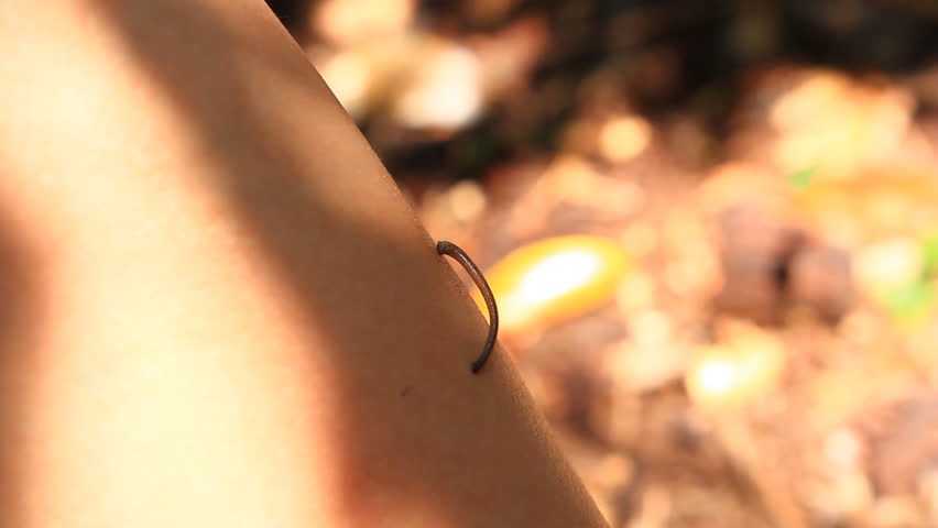 leech on a woman