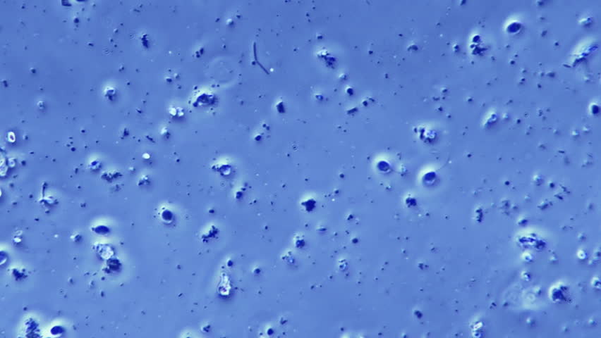 Bacteria Flagellum Sample in Phase Stock Footage Video (100% Royalty