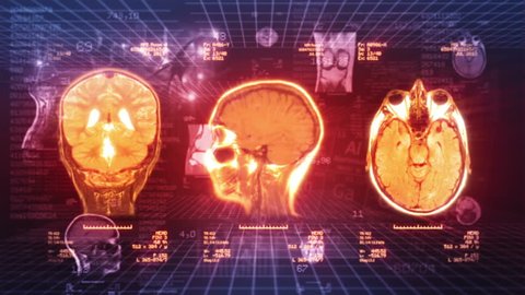 Medical Background. Video showing MRI, neurons, chart, numbers and data animations. Loopable. Red/orange. Locked. 
MORE COLOR OPTIONS IN MY PORTFOLIO.