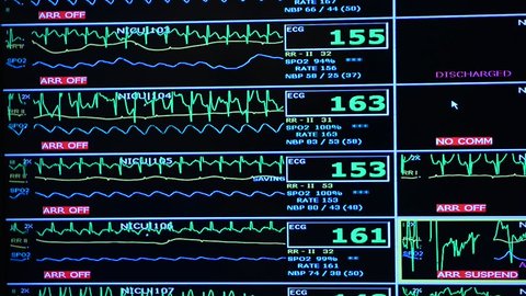 Overall nurses station monitor in the Neonatal intensive care unit (NICU).  ECG monitor screen, hd, 1080p high definition.
