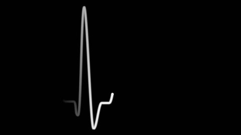 Green heart pulse line. Animation of EKG heart beat on black background, loopable, alpha channel included