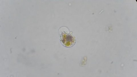 single-celled protozoan, ameba from pond under microscope, magnif. 600x