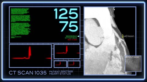 A fictional hospital computer screen monitoring a human heart.
