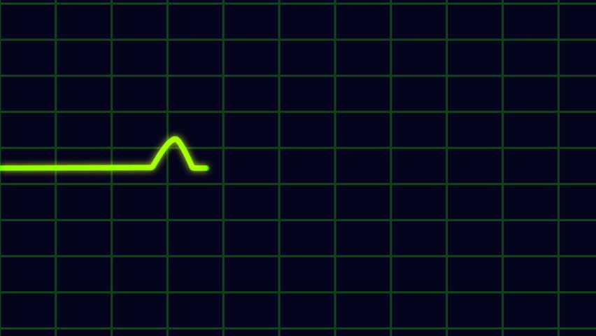 Ekg Heart Monitor Goes Flatline Stock Footage Video (100% Royalty-free