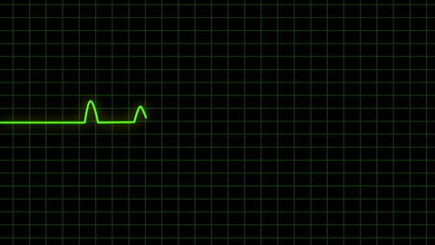 Ekg Heart Monitor Goes Flatline