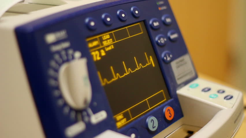 A defibrillator showing a normal sinus rhythm.
