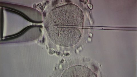IVF, in vitro fertilisation through a microscope, MEDICINE