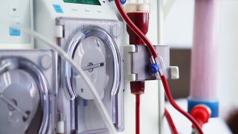 Arlificial kidney (dialysis) medical device with rotating pumps