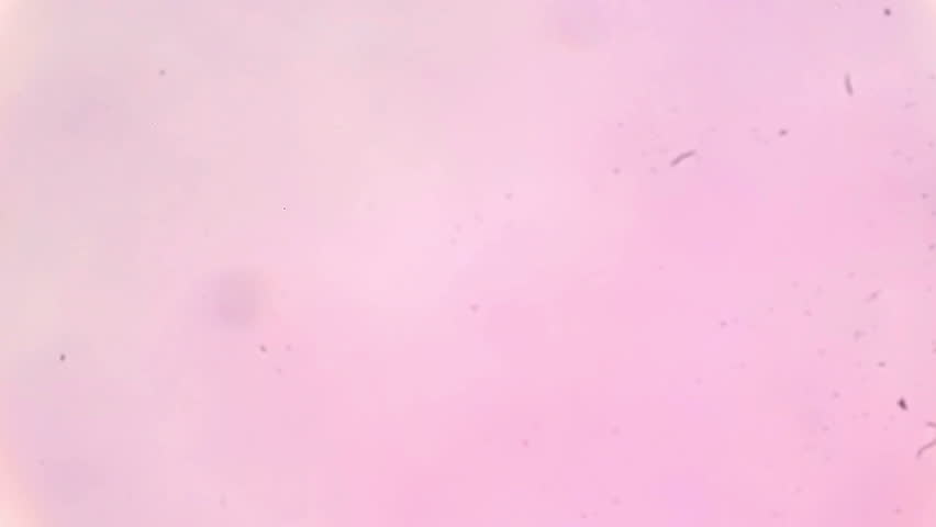 Fish blood cell under a microscope (Blood Smear Fish), Full HD
