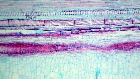 longitudinal section of a stem