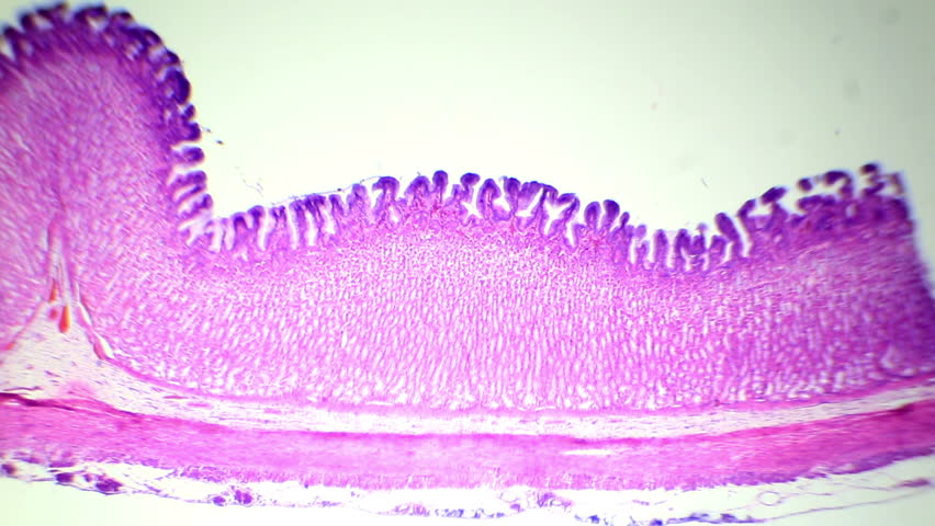 Ткани желудка. Ткани желудка под микроскопом. Желудок под микроскопом. Клетки слизистой желудка под микроскопом. Ткань стенки желудка под микроскопом.