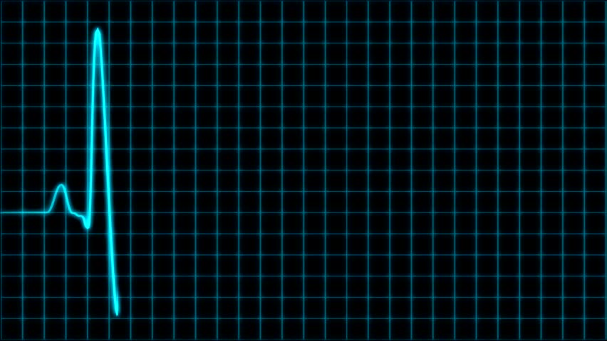 cardiograph learning