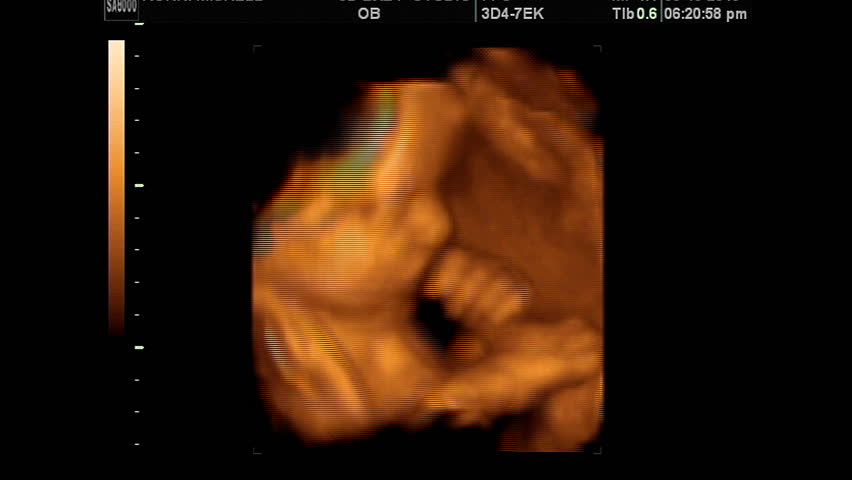 4d ultrasound near me boise