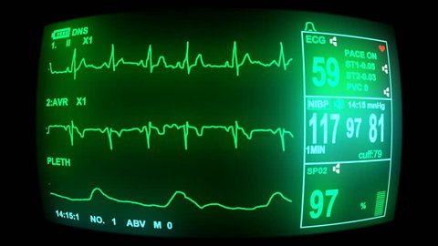 4k ECG monitor screen, hd, 1080p high definition, seamless loop  (ultra Hd, seamless loop, 3840 X 2160, ready for compositing)