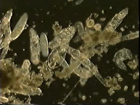 A drop of pond water teems with microscopic life-mostly rotifers and Paramecium