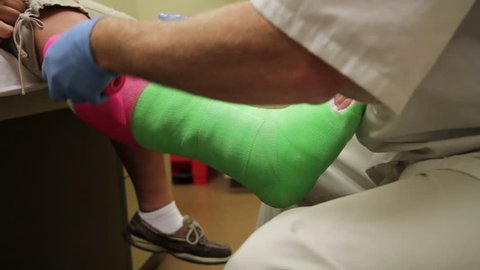 Wrapping Cast on Leg