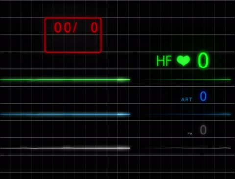 Stylized Ekg Flatline Green Close Stock Footage Video 100 Royalty Free 1023540532 Shutterstock