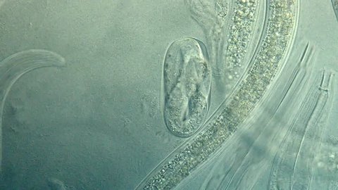 Caenorhabditis elegans, a free-living, transparent nematode (roundworm)
