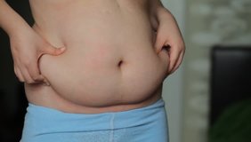 Video body of the baby boy scarred by surgery obesity, metabolic disease